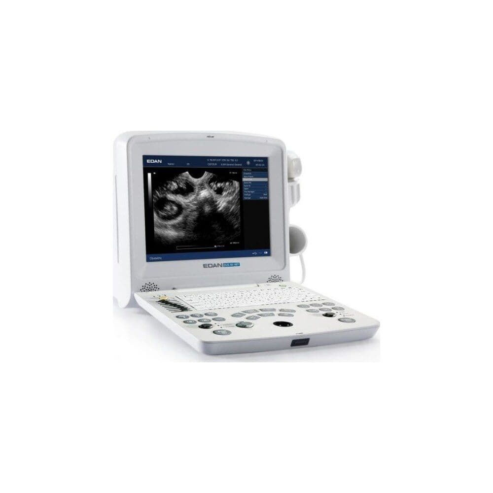 EDAN DUS 60 Vet portable ultrasound system with a fold-up screen and keyboard